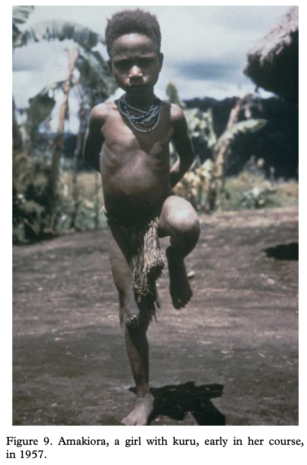 Fore photographs and regional genetic reference material., image 9 of 14