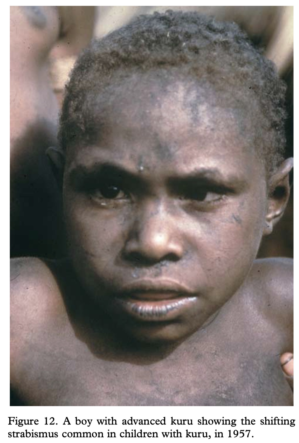 Fore photographs and regional genetic reference material., image 12 of 14