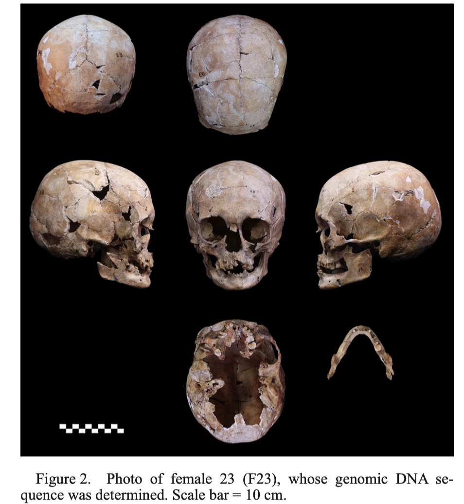 Multiple views of the reconstructed skull and mandible of the female Funadomari individual F23